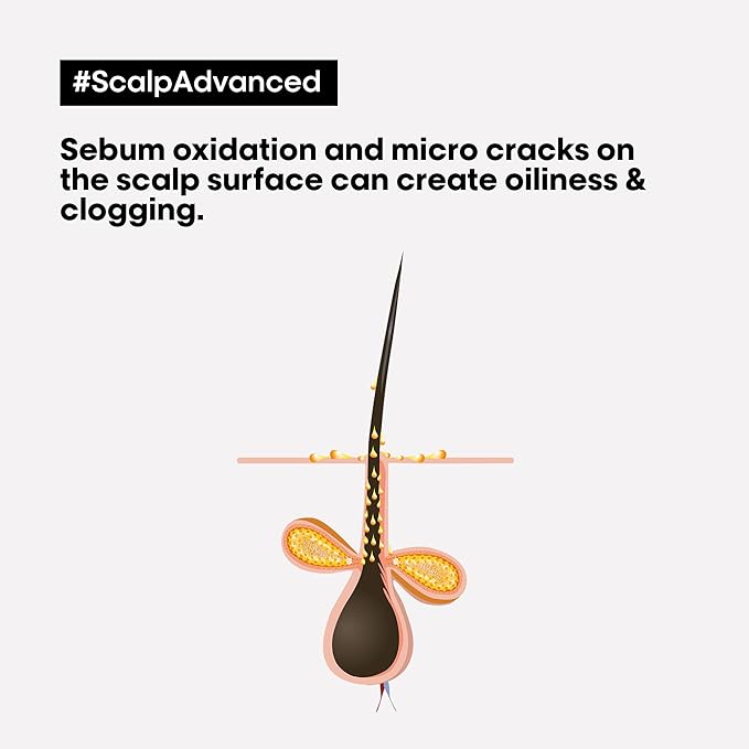 L'Oréal Professionnel Scalp Advanced Anti-Discomfort Dermo-Regulator Shampoo 300ml