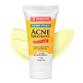 De la cruz cream 74g for acne prone skin with 10% sulfur