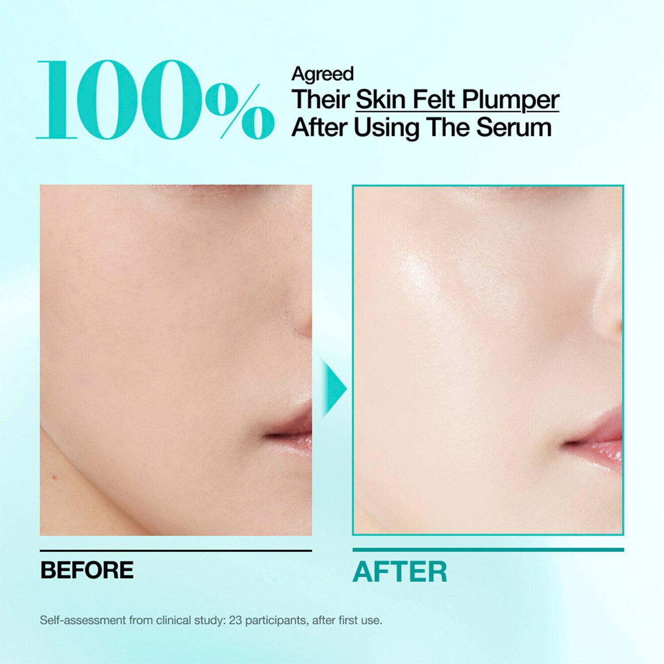 Anua PDRN Hyaluronic Acid Capsule 100+ Serum – Deep Hydration & Skin Repair 30ml