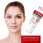 ACM Sebionex Hydra Repair Cream – Hydrating Barrier Care for Sebum Control