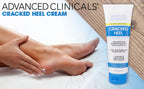 Advanced Clinicals Foot Cream – Intensive Moisturizer for Dry Feet