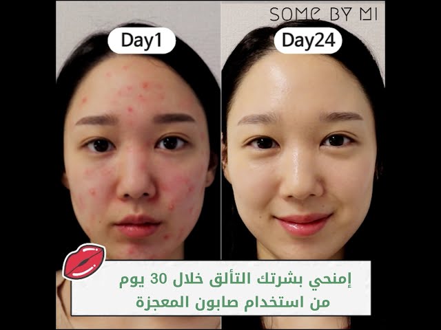 صابونة تنظيف الوجه من سوم باي مي