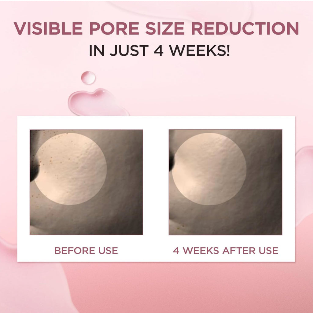 SKIN1004 جل كريم مدغشقر سينتيلا 75 مل لتنقية البشرة