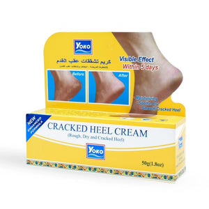كريم يوكو للقدمين – كريم مرطب مكثف للكعبين الجافين – 50 جرام